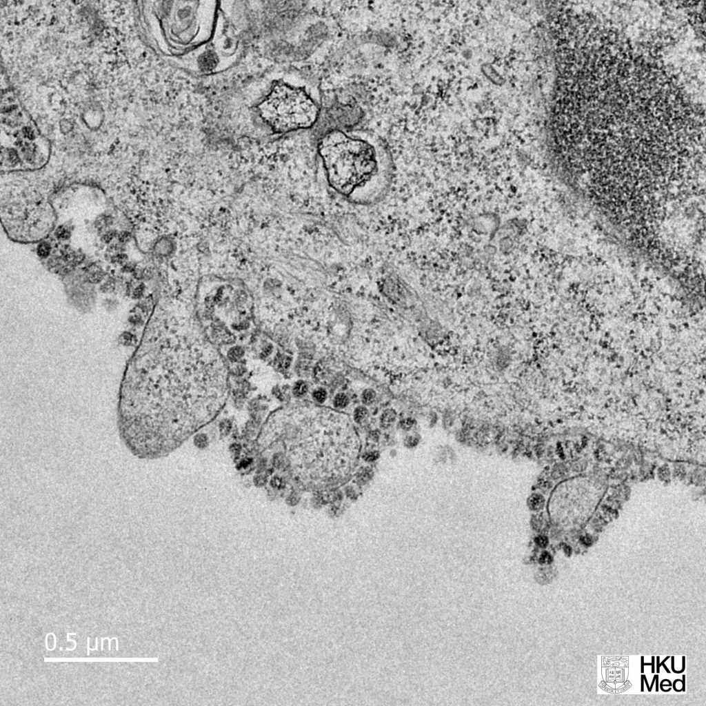 foto del coronavirus de wuhan por la universidad de hong kong
