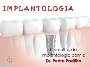 C9fc3ead 91ad 4a59 b1d9 ffe1ff5ccdaa fotografia profissional rosto implantologia jpeg