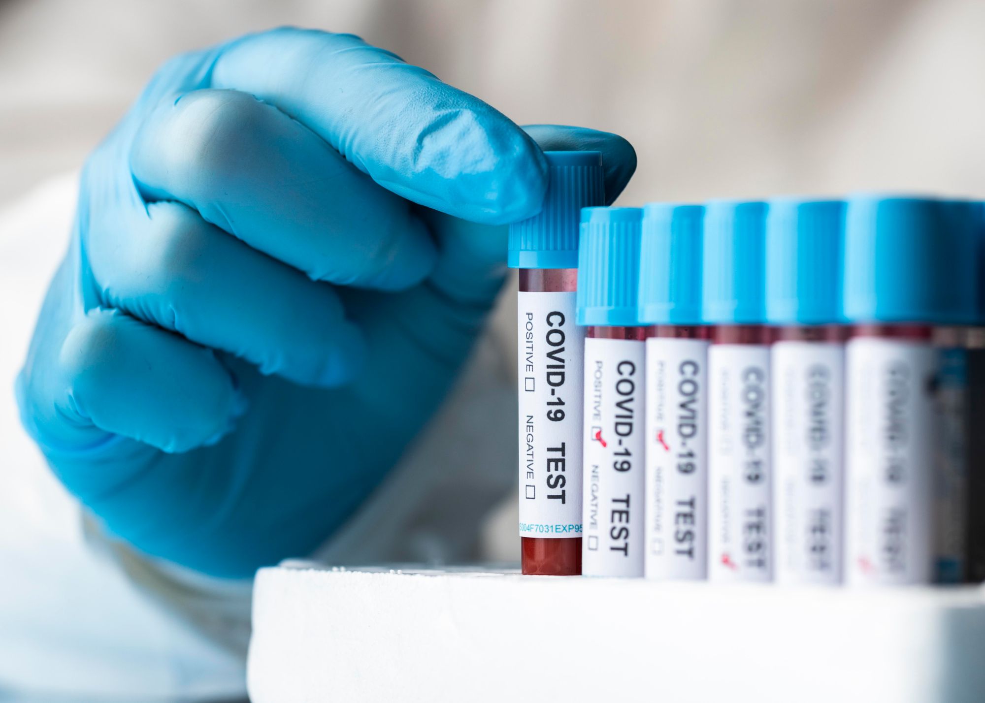 Variant Frankenstein du Covid-19 : quelles précautions adopter au quotidien ?